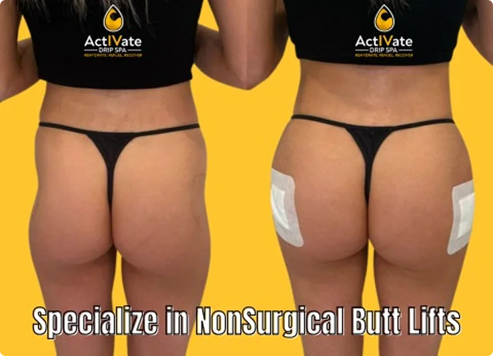 Fat Reduction & Contouring