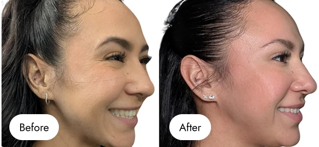 before-after-img-1