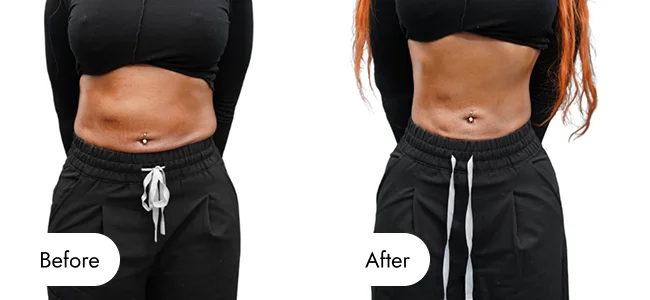 before-after-img-10