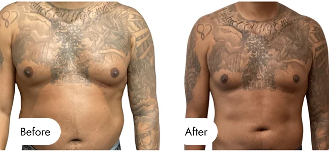 before-after-img-12