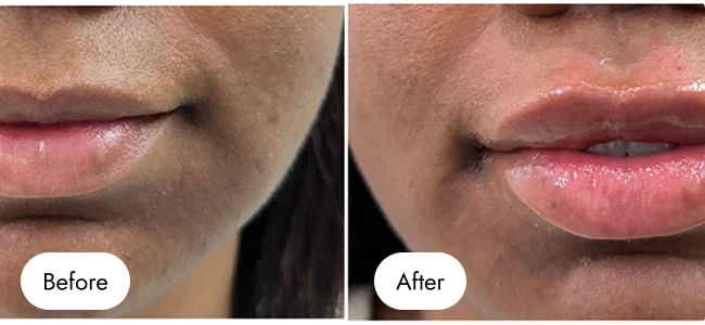 before-after-img-13