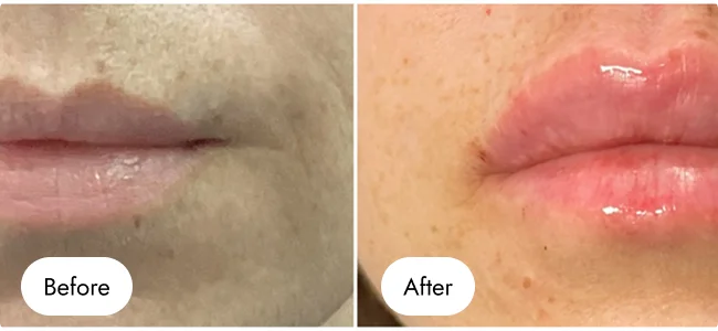 before-after-img-14