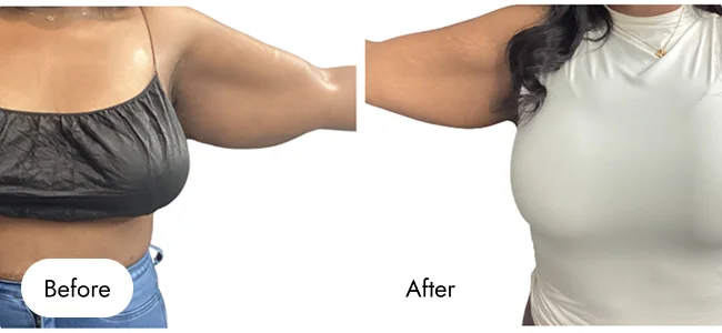 before-after-img-15