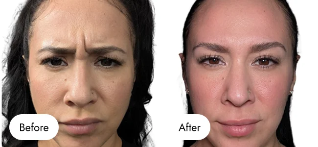 before-after-img-2