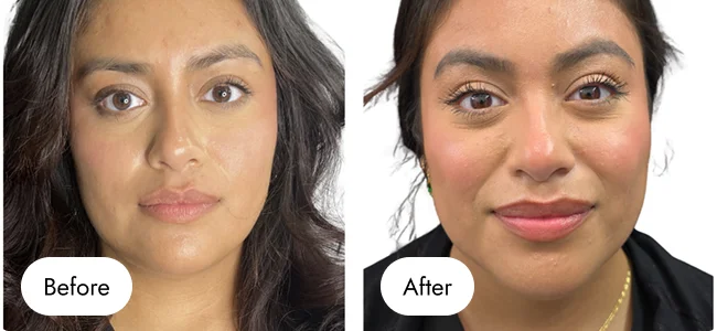 before-after-img-3