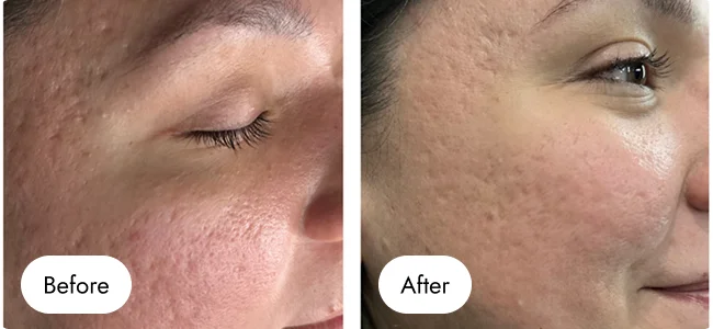 before-after-img-4