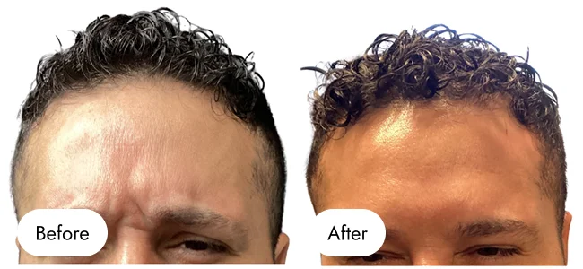 before-after-img-5