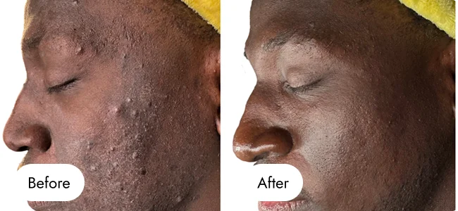 before-after-img-6