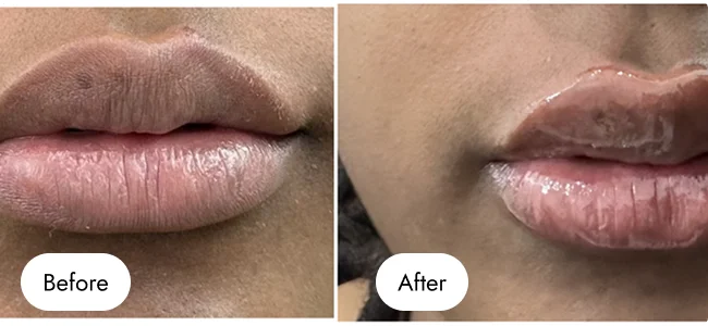 before-after-img-7