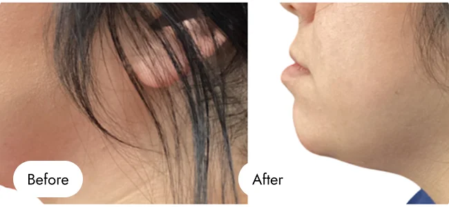 before-after-img-8