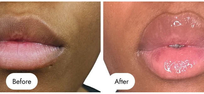 before-after-img-9